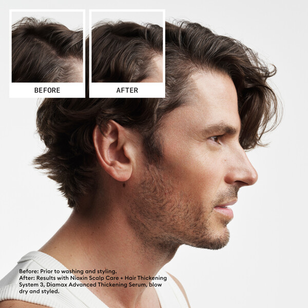 Hair System Kit 2 (Bild 2 av 6)